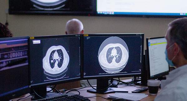 Interdisziplinäre Tumorkonferenz im Uroonkologischen Zentrum Ärztliche Besprechung radiologischer Aufnahmen im Rahmen einer Tumorkonferenz
