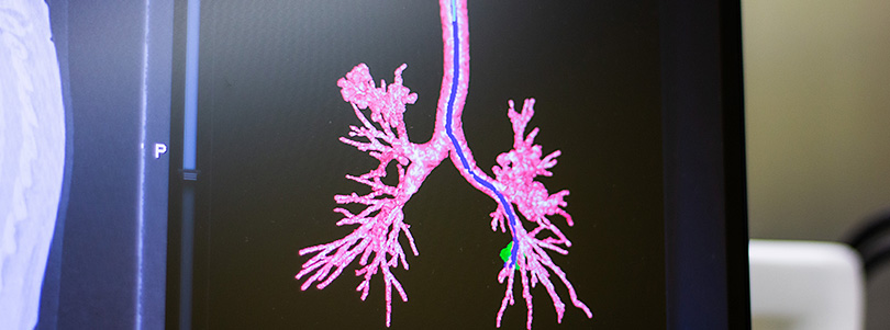 Pneumologie