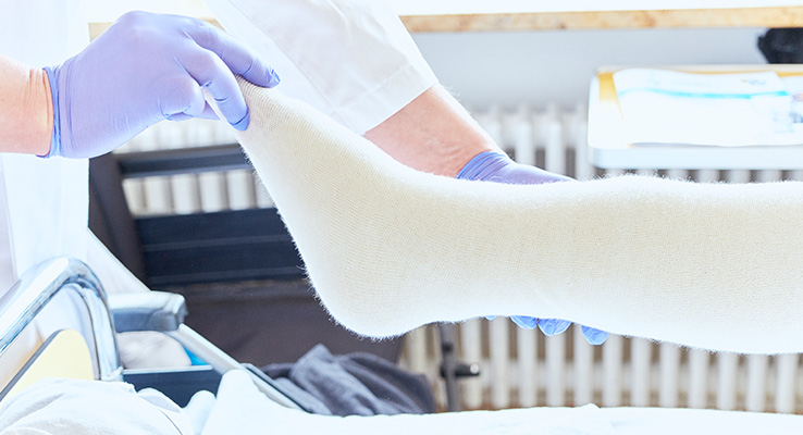 Untersuchung Bein Gefäßchirurgie Untersuchung Bein Gefäßchirurgie