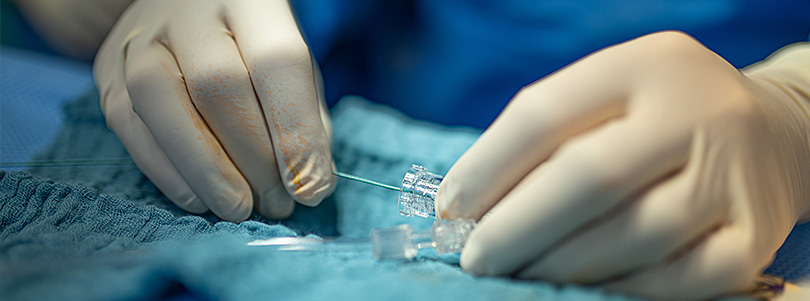 Interventionelle Radiologie