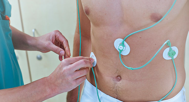 Belastungs EKG Kardiologie