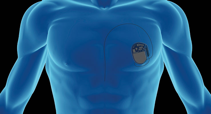 Herzkatheter Kardiologie