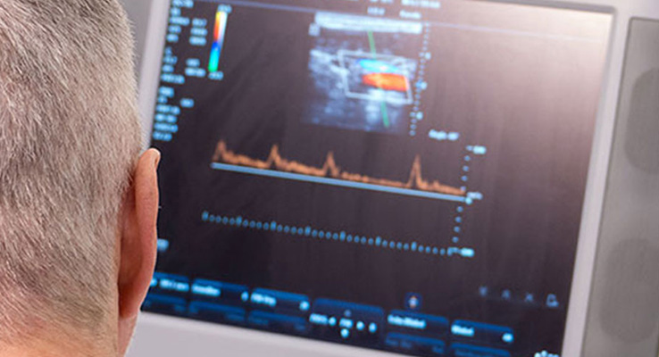 Ultraschalluntersuchung des Blutflusses Mann bei einer Doppler-Ultraschalluntersuchung