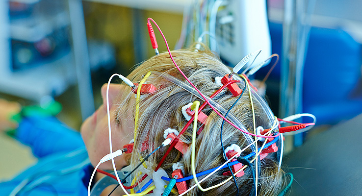 Neurologie