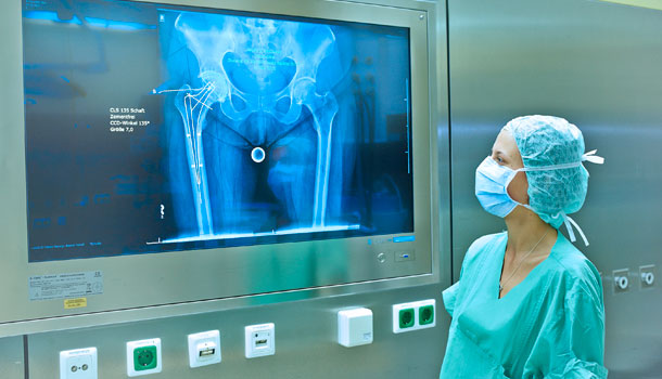 Ärztin vor Monitor Darstellung Hüftgelenk Schwerpunkt Orthopädie
