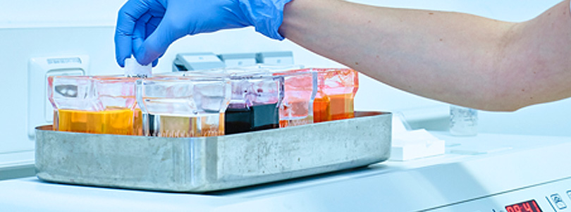 Schnellschnittdiagnostik Pathologie